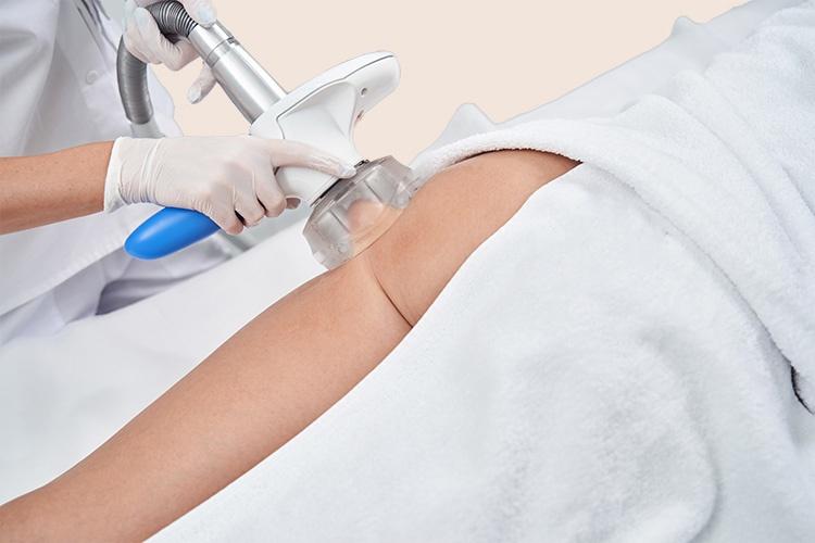 Elimination graisses amincissement Waterloo Pure Skin Belgium