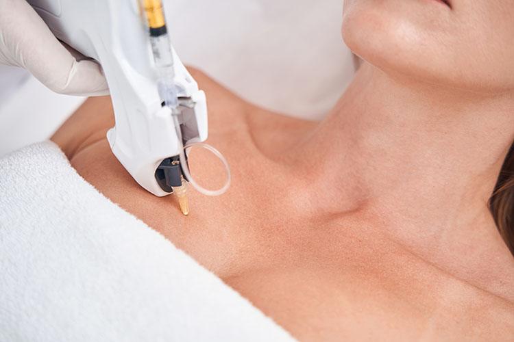 mesotherapie-corporelle
